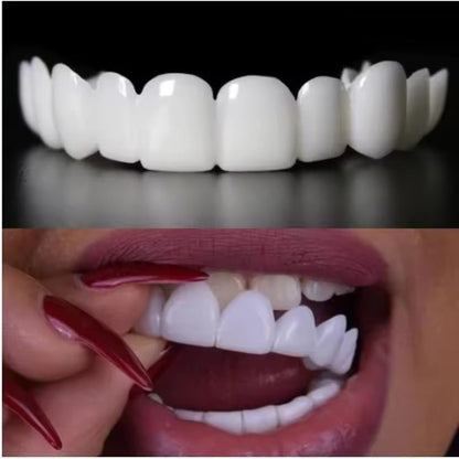 TerraHush™ Snap-On Veneers